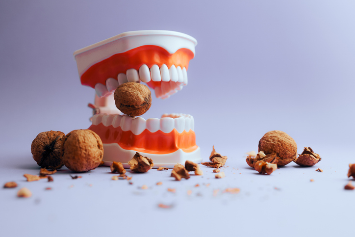 Featured image for Foods To Avoid After Dental Implant Surgery